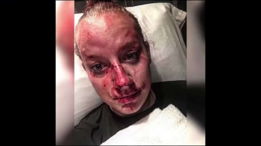 Brutally Assaulted Officer Accepts Our Invitation!