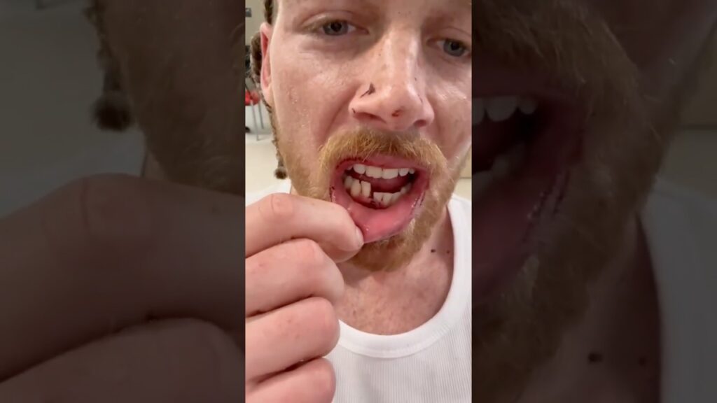 Guy BREAKS JAW in 1 Minute Scrap #ufc #scrap