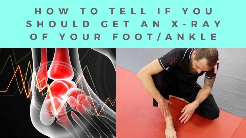 How To Tell If You Need An X-ray Of Your Foot