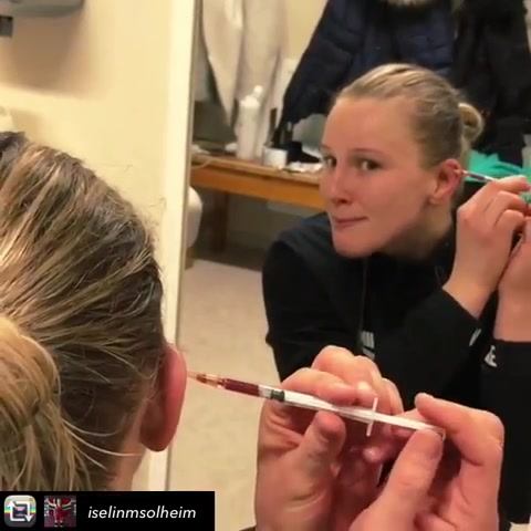 Warrior Girls#cauliflowerear