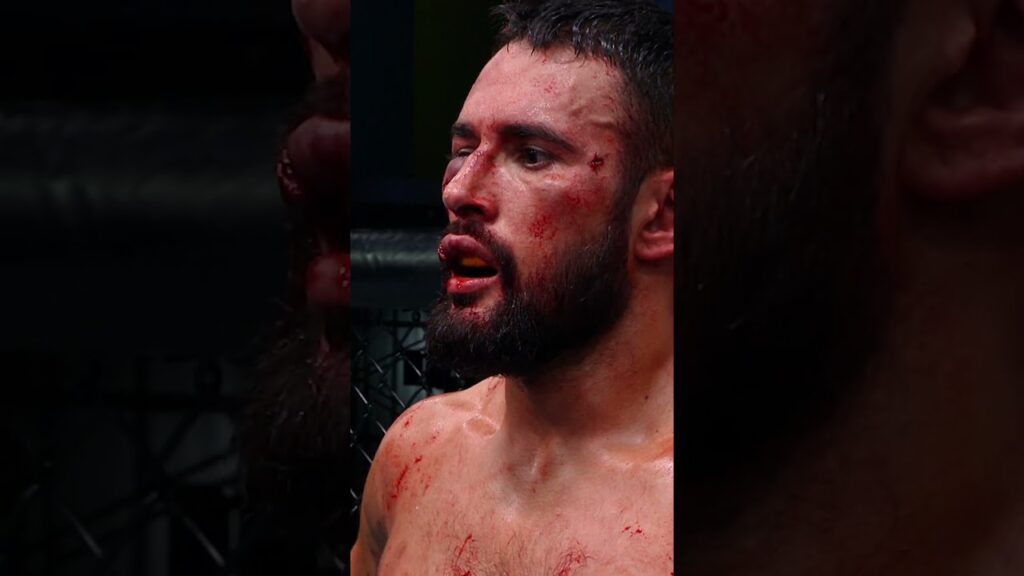 he DESTROYED his face 😳 #ufcparis